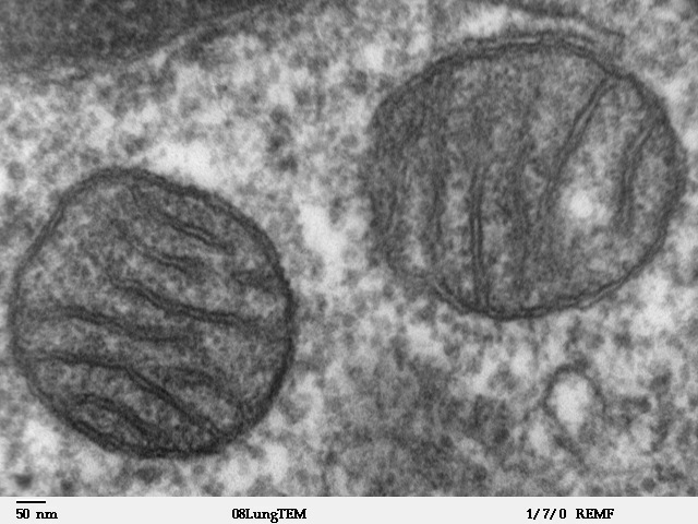 Electron micrograph showing two organelles with folded inner membranes